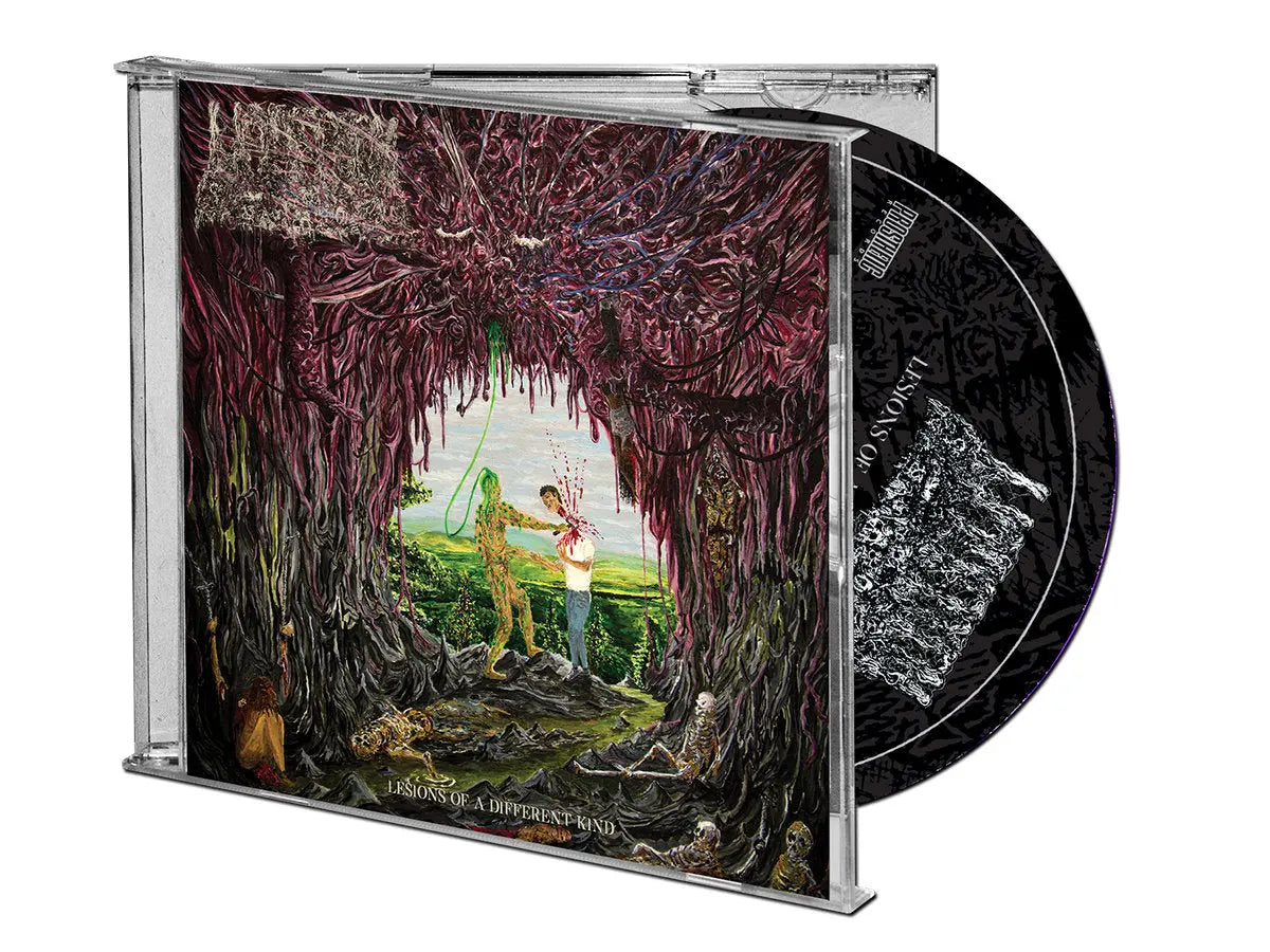 Undeath - Lesions of a Different Kind CD Prosthetic Records
