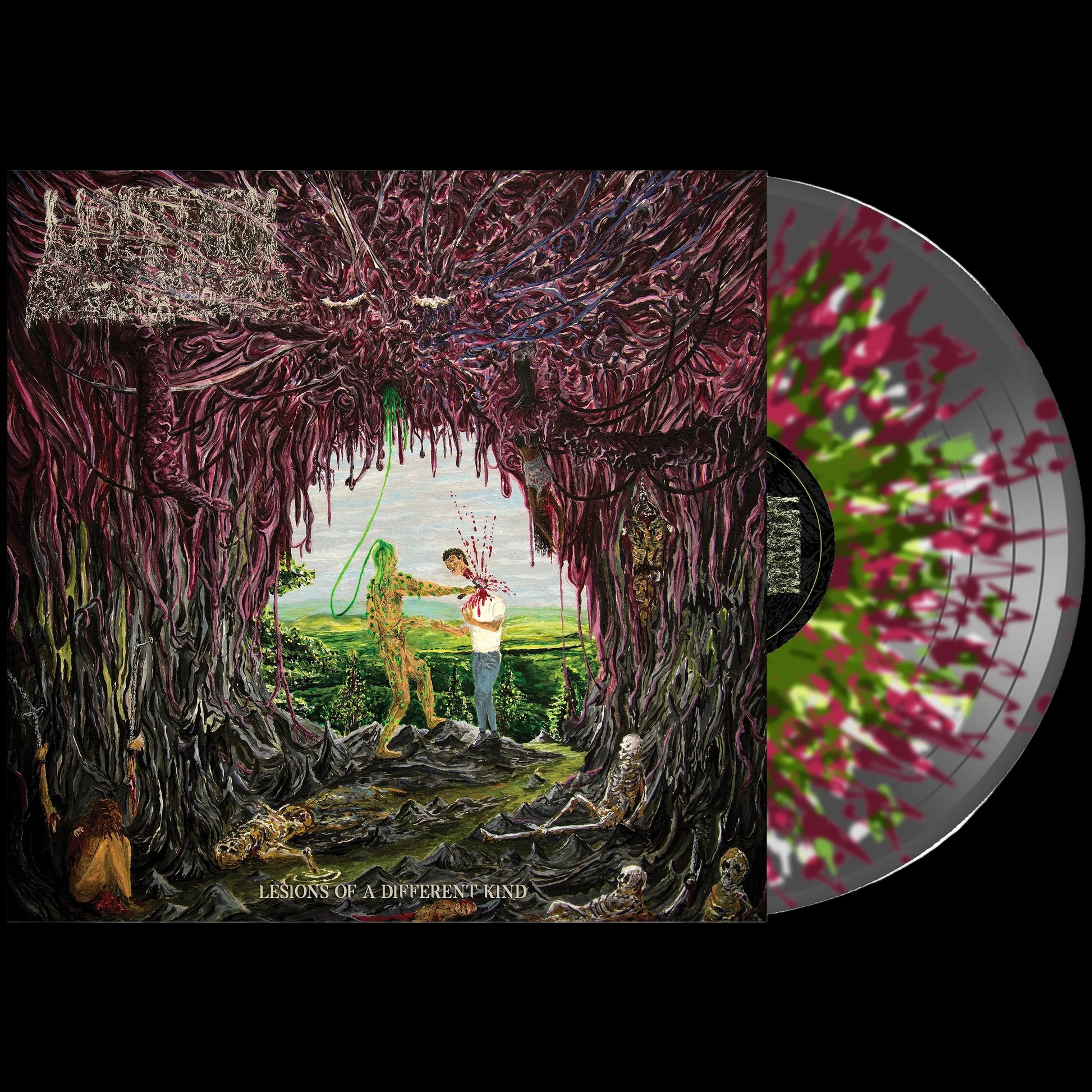 Undeath "Lesions of A Different Kind" Vinyl (Choose Color) - Mainstay Entertainment
