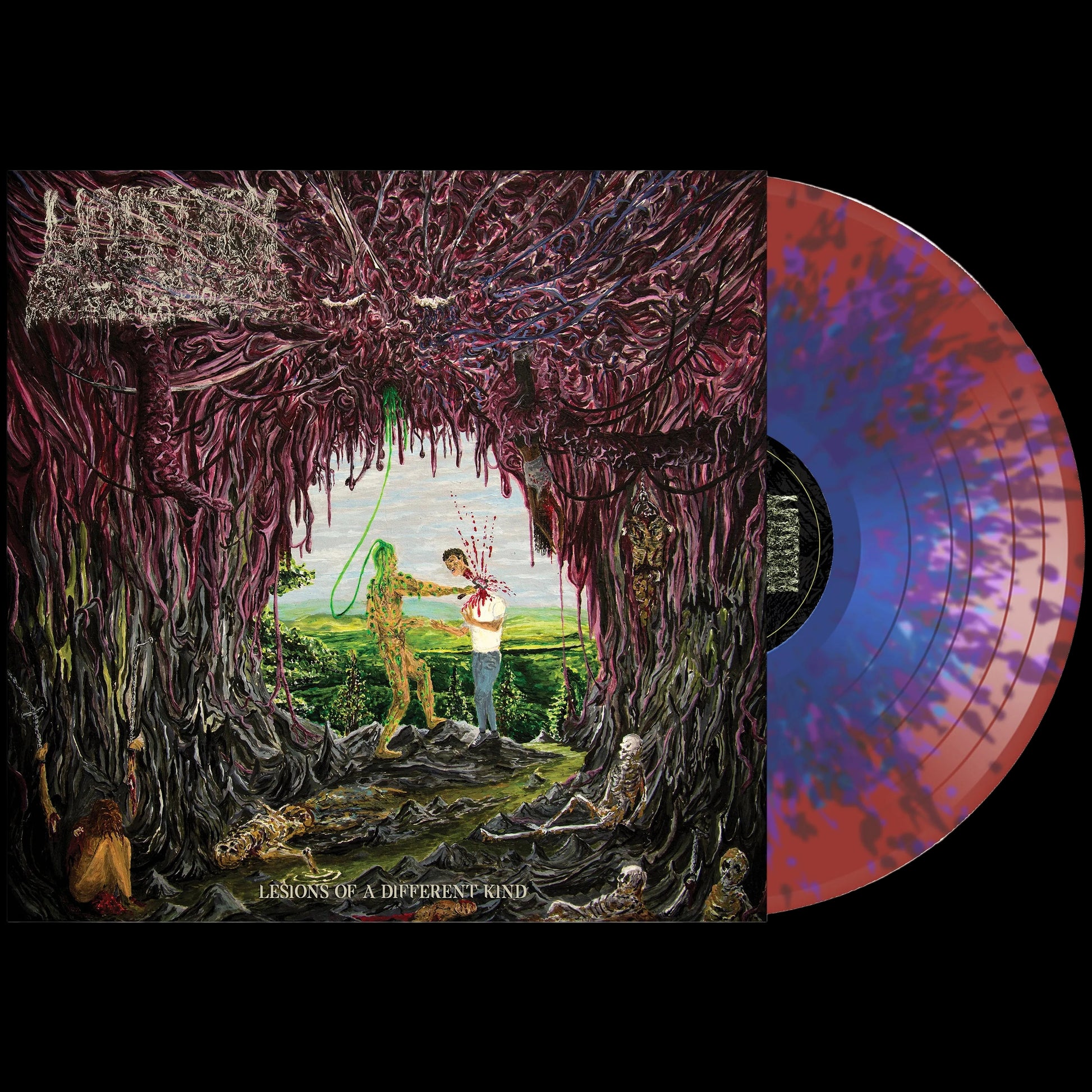 Undeath "Lesions of A Different Kind" Vinyl (Choose Color) - Mainstay Entertainment