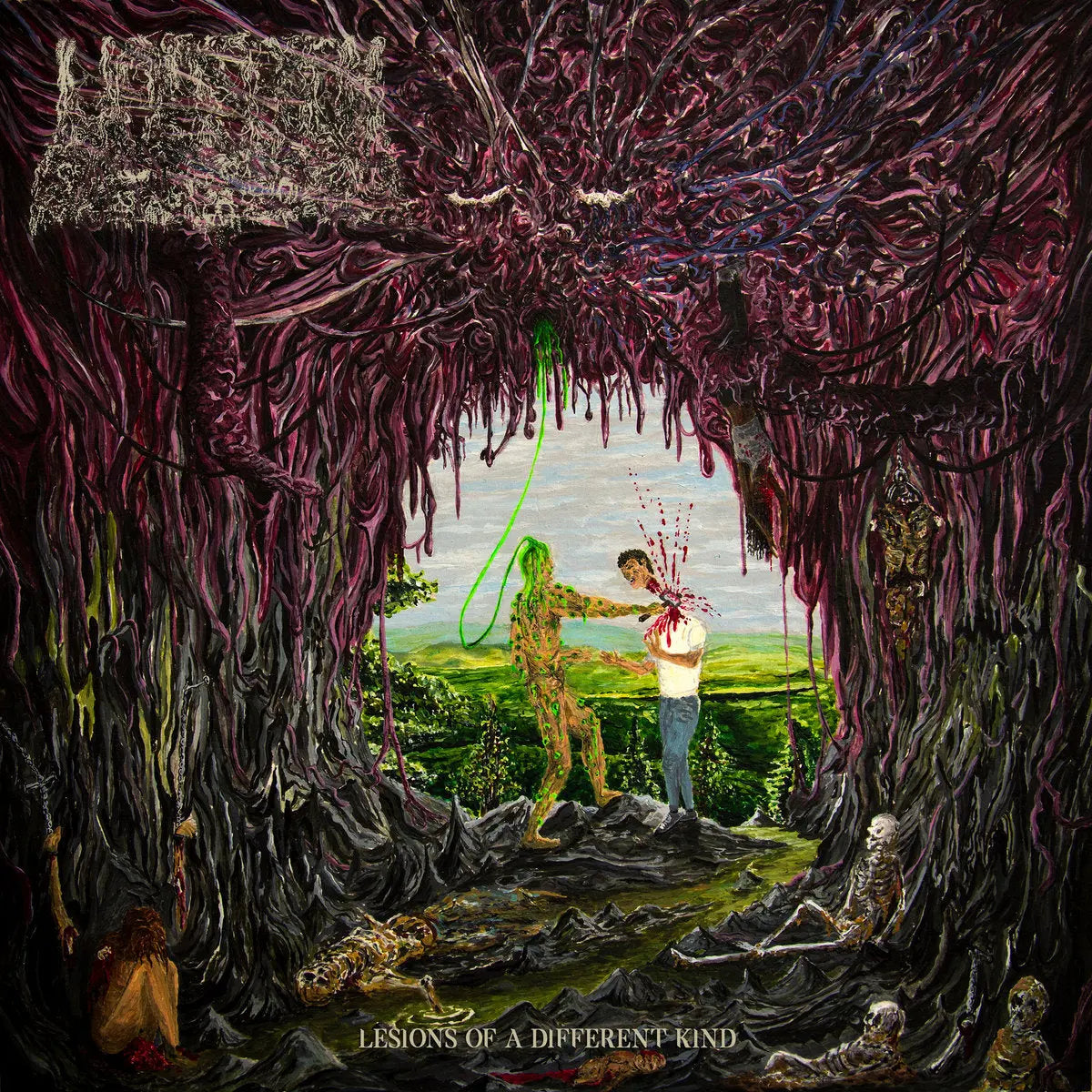 Undeath - Lesions of a Different Kind CD Prosthetic Records