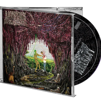 Undeath - Lesions of a Different Kind CD Prosthetic Records