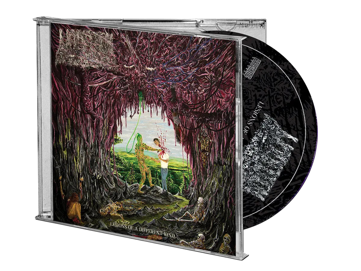 Undeath - Lesions of a Different Kind CD Prosthetic Records